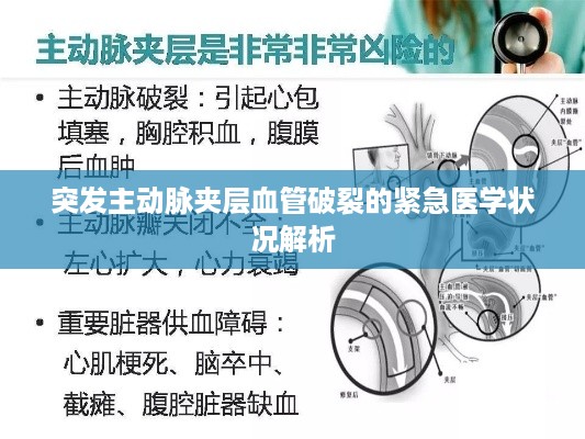 突发主动脉夹层血管破裂的紧急医学状况解析